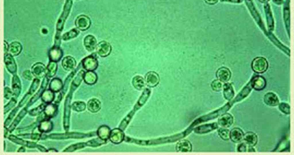 candida-1024px-e1408168954341