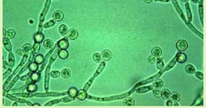 candida-1024px-e1408168954341